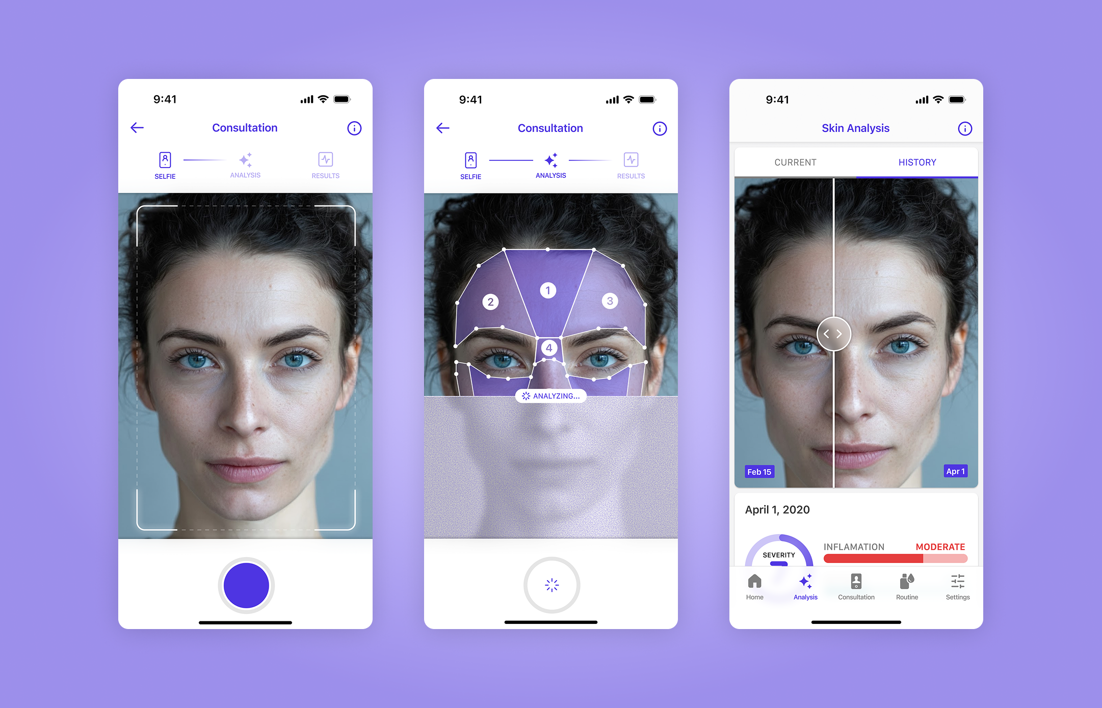 AI-powered skin analysis and acne care subscription app.