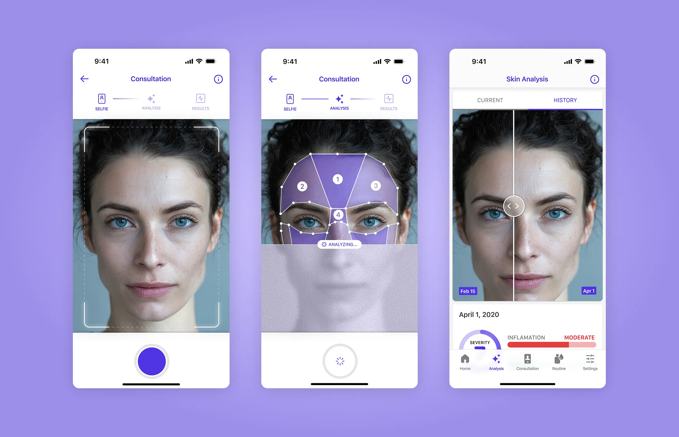 AI-powered skin analysis and acne care subscription app.